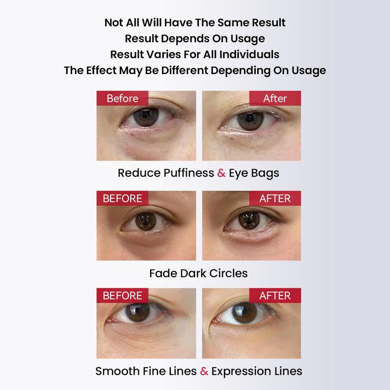 AMIRO PDRN Red Light Eye Cream, Anti-Aging Eye Treatment for Dark Circles and Puffiness, Repairing & Firming Eye Cream with PDRN & Red Light Therapy, Smooth Fine Lines and Reduce Eye Bags